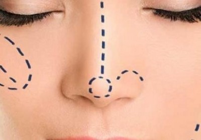 عوارض جانبی جراحی زیبایی بینی