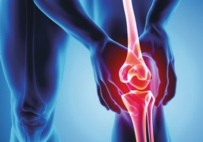 عوامل تاثیرگذار بر ایجاد آرتروز
