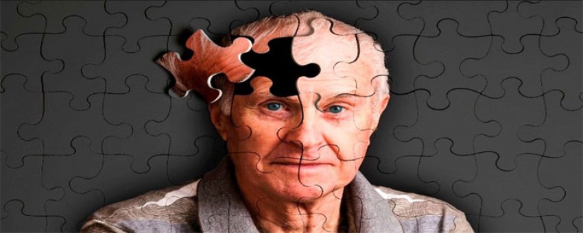 جهش ژنتیک و تاثیر در پیشرفت الزایمر