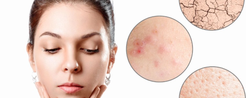 انواع رژیم غذایی مناسب پوست