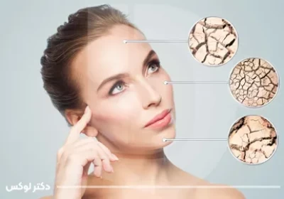 راهنمای انتخاب بهترین مرطوب کننده پوست خشک