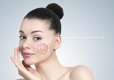عروق عنکبوتی چیست؟ بررسی علل و بهترین روش درمان